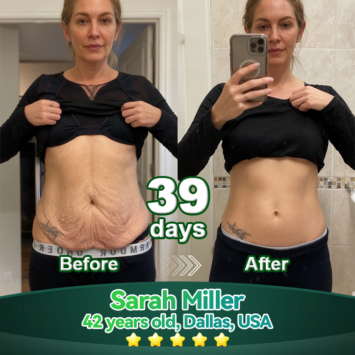 𝐿𝑜𝑡𝑚𝑎𝑦® 𝑆𝑡𝑒𝑚 𝐶𝑒𝑙𝑙 & 𝐶𝑜𝑙𝑙𝑎𝑔𝑒𝑛 𝑃𝑒𝑝𝑡𝑖𝑑𝑒 𝑂𝑟𝑎𝑙 𝐷𝑟𝑜𝑝𝑠🧨🚀(Lift & Firm Sagging Skin & Reduce Wrinkle Formation)👩‍⚕️