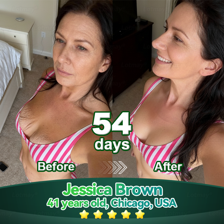 𝐿𝑜𝑡𝑚𝑎𝑦® 𝑆𝑡𝑒𝑚 𝐶𝑒𝑙𝑙 & 𝐶𝑜𝑙𝑙𝑎𝑔𝑒𝑛 𝑃𝑒𝑝𝑡𝑖𝑑𝑒 𝑂𝑟𝑎𝑙 𝐷𝑟𝑜𝑝𝑠🧨🚀(Lift & Firm Sagging Skin & Reduce Wrinkle Formation)👩‍⚕️